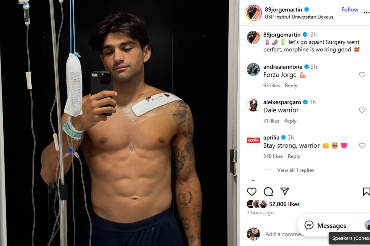 MotoGP, Aprilia, Sirkuit Mandalika, Jorge Martin, Marco Bezzecchi, motogp 2025, MotoGP Indonesia 2025, MotoGP Jepang 2025, Update Kondisi Jorge Martin: Operasi Sukses, Absen di Mandalika