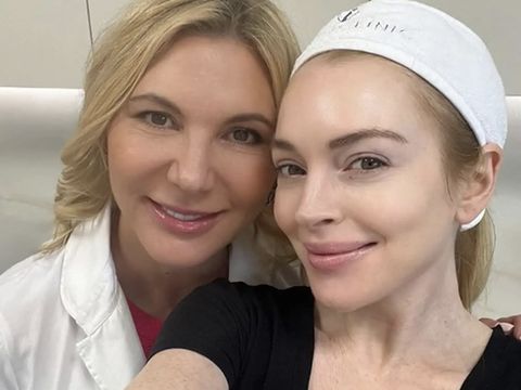 Array,Lindsay Lohan Tampil Glowing dan Awet Muda Tanpa Makeup, Diduga Oplas